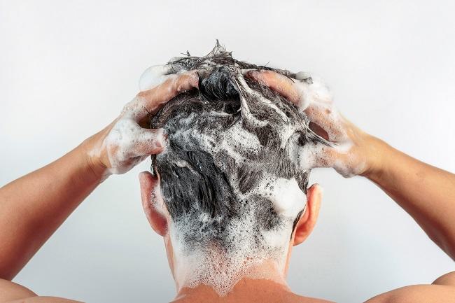cara mengatasi rambut rontok